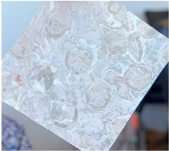 dHCAM Medicare coverage list Medicare-assigned amniotic membrane allografts Medicare updated quarterly all amniotic membrane skin substitute for chronic wound care available through a HIPPA secure portal to make membrane use more streamlined, efficient, insurance authorizations, best price, early payment discount and discounted billing along with claw back insurance